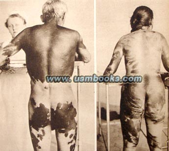 tortured ethnic Germans